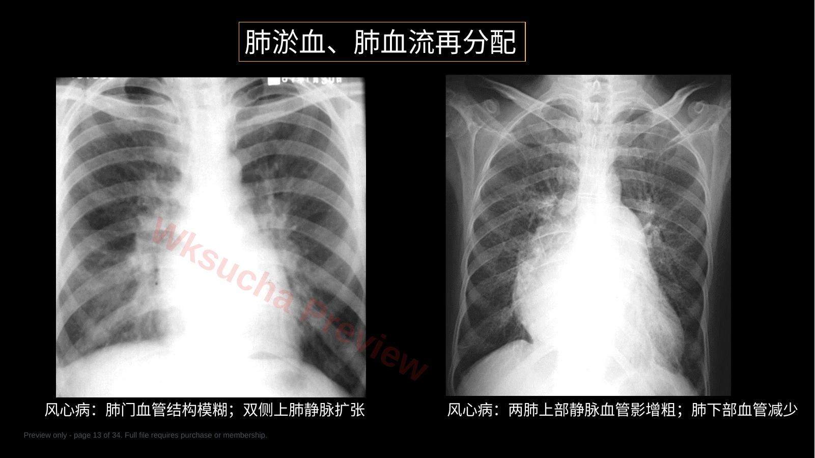 预览第 13 页