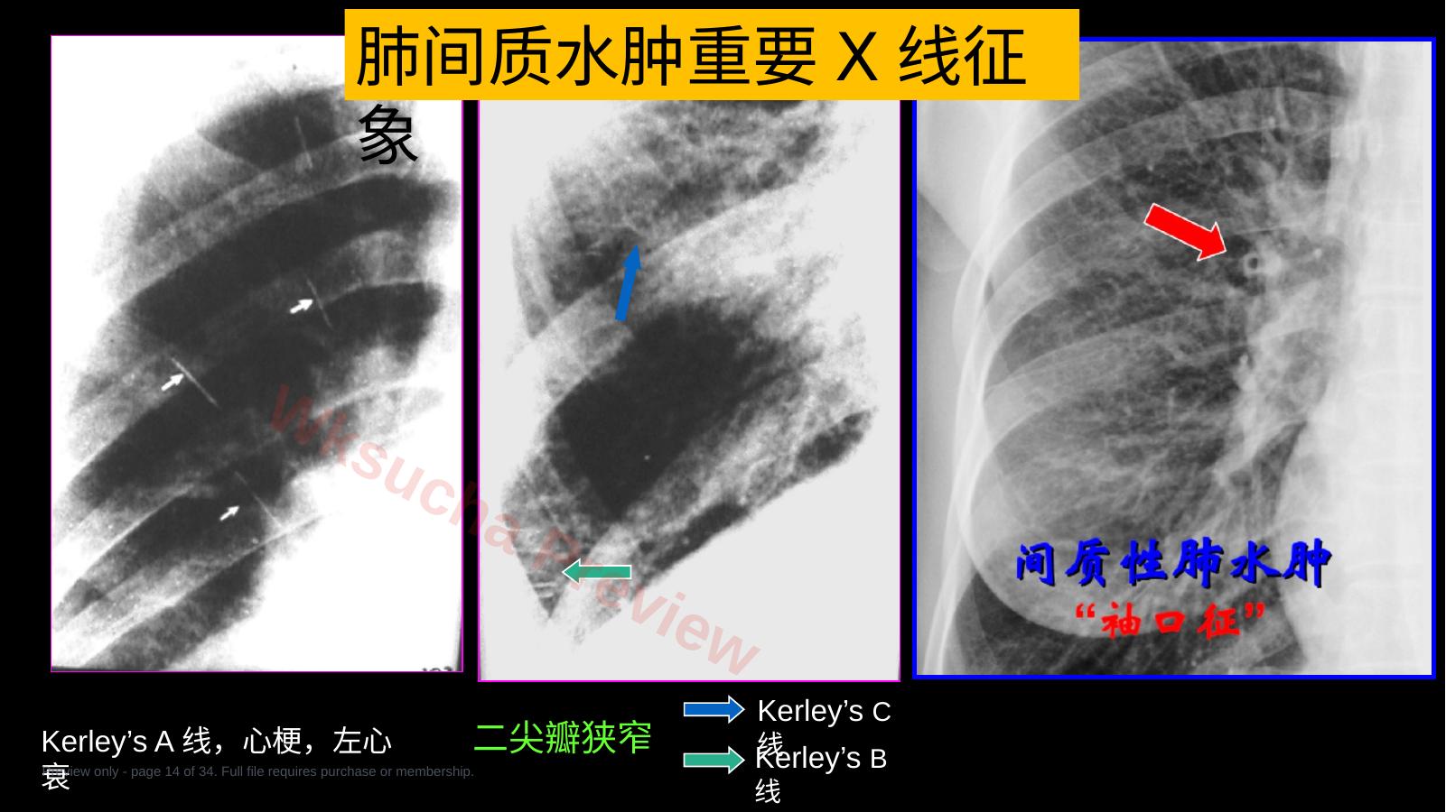 预览第 14 页