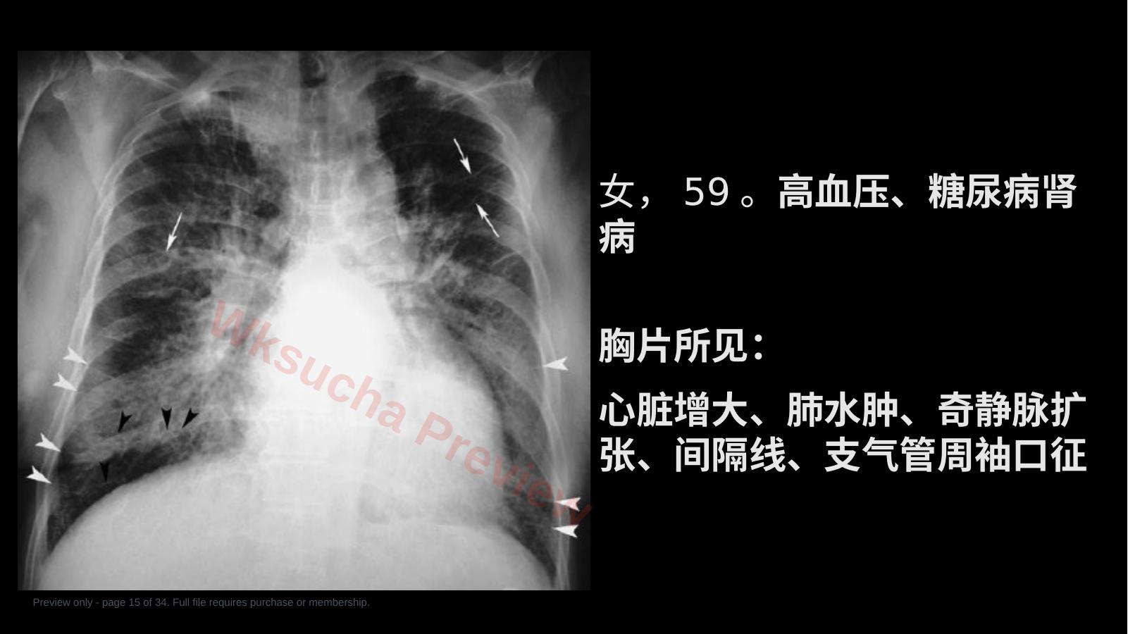 预览第 15 页