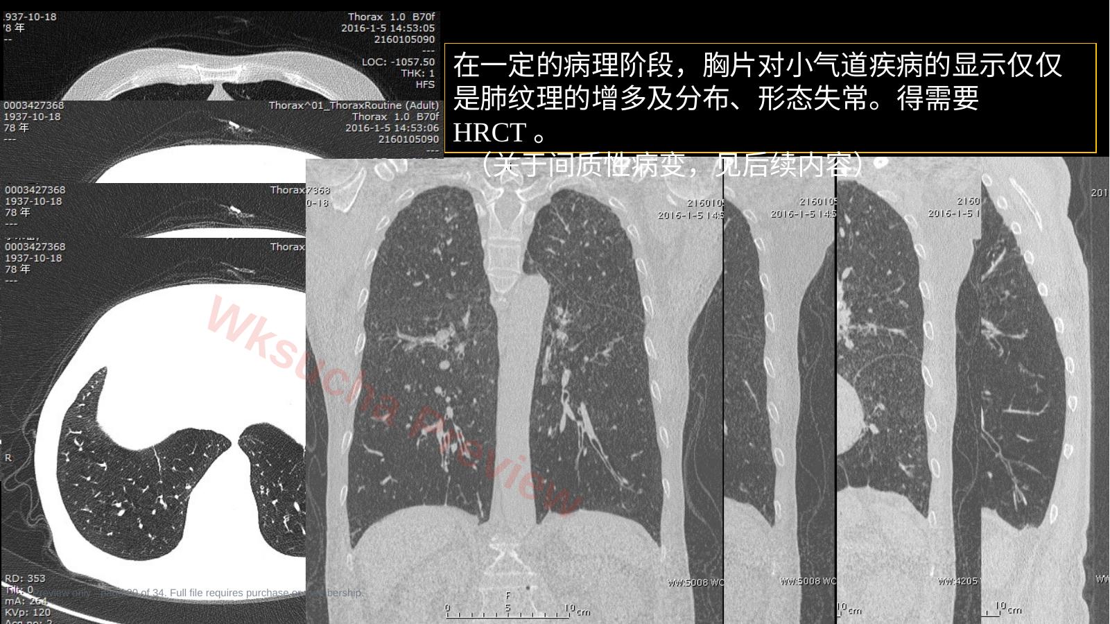预览第 20 页
