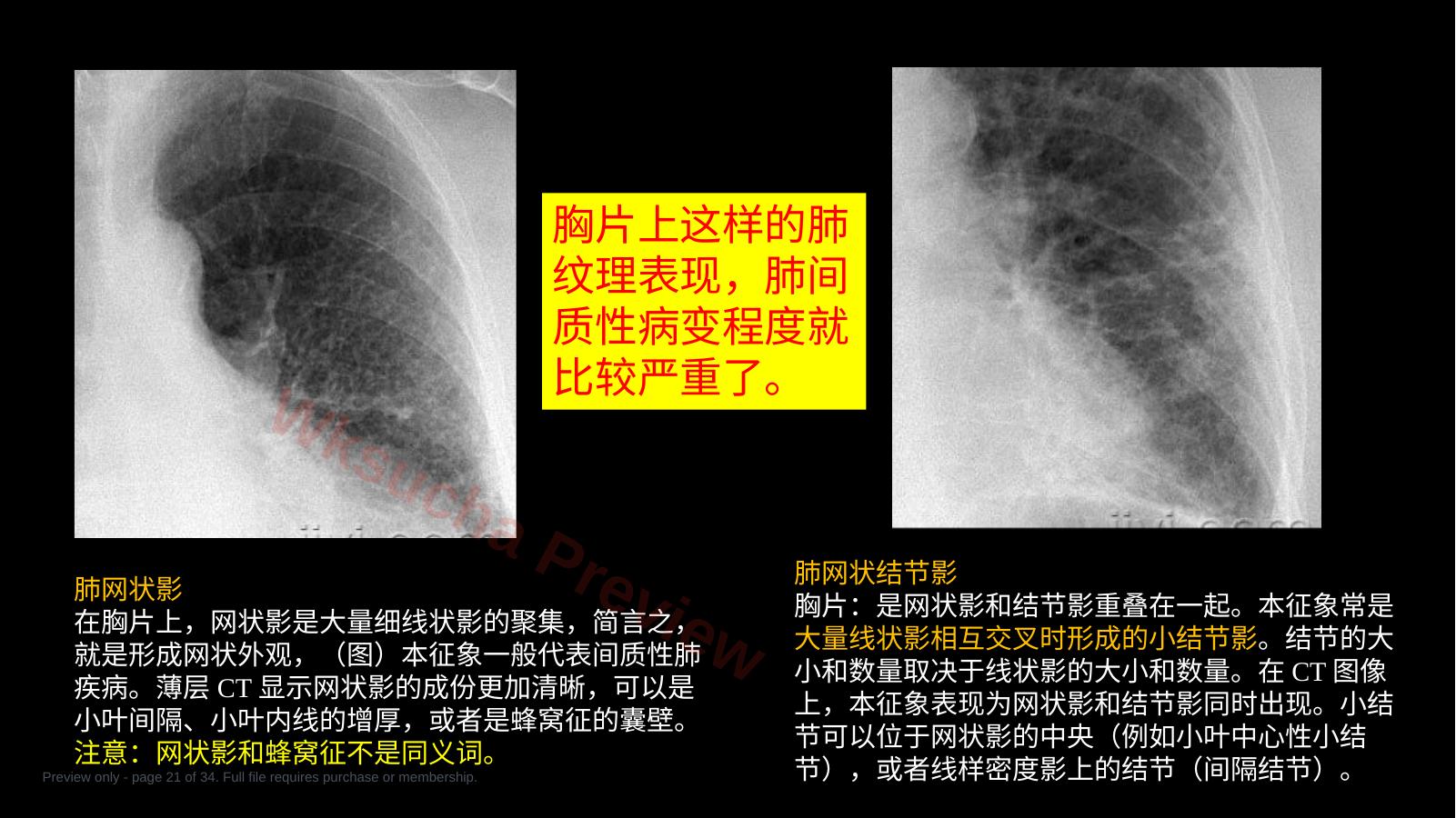 预览第 21 页