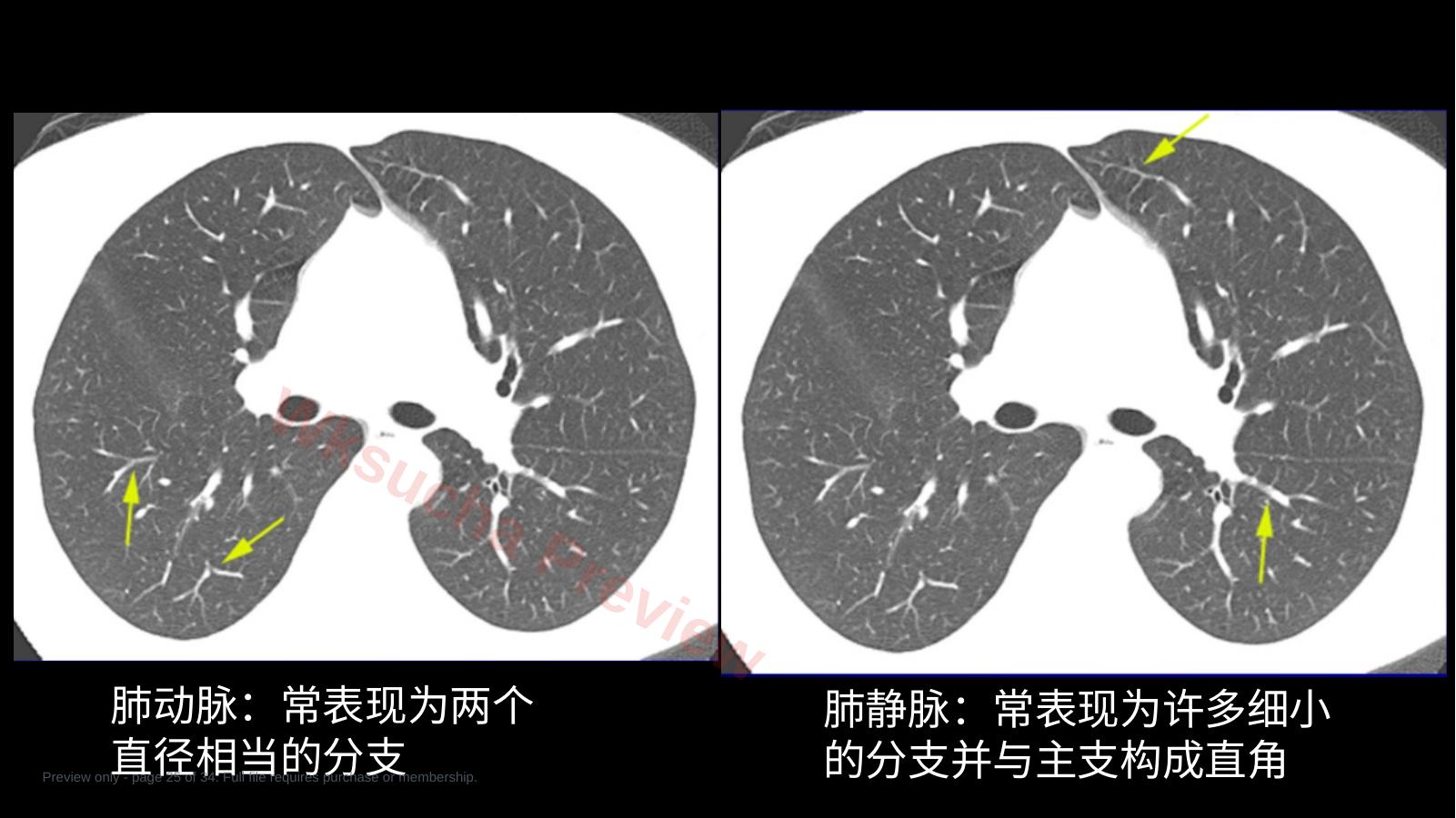 预览第 25 页