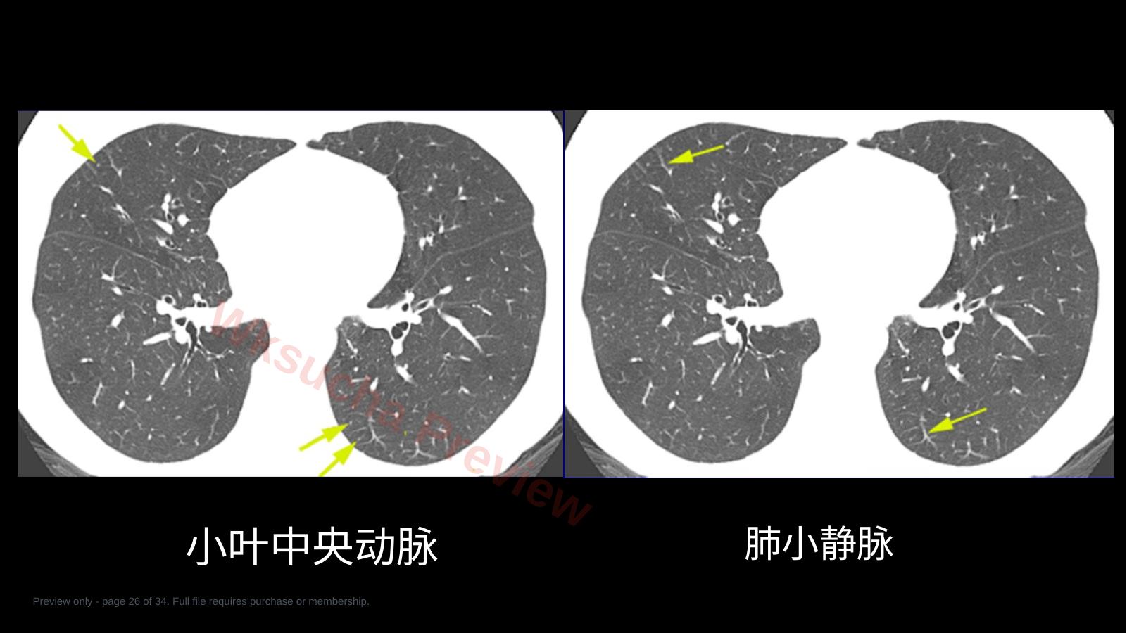 预览第 26 页