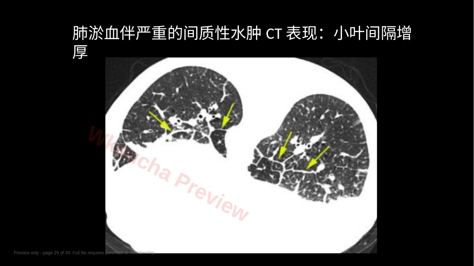预览第 29 页