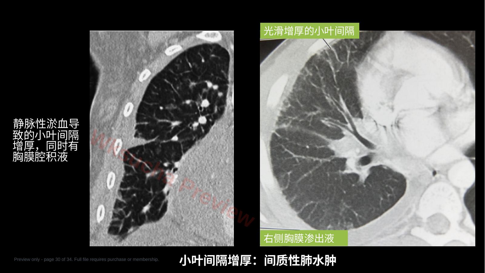 预览第 30 页