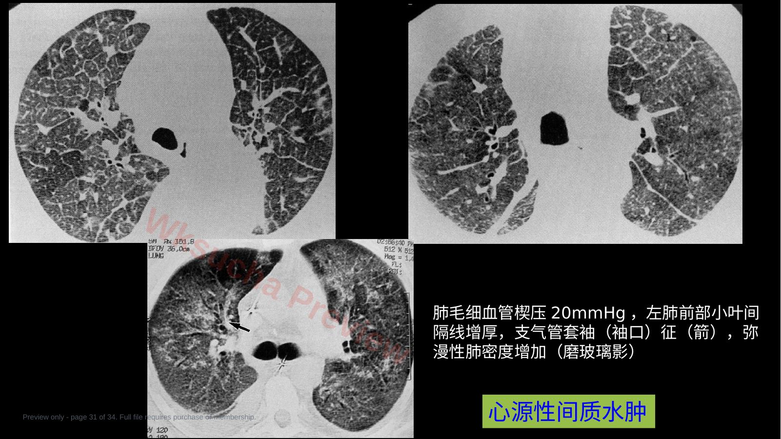 预览第 31 页