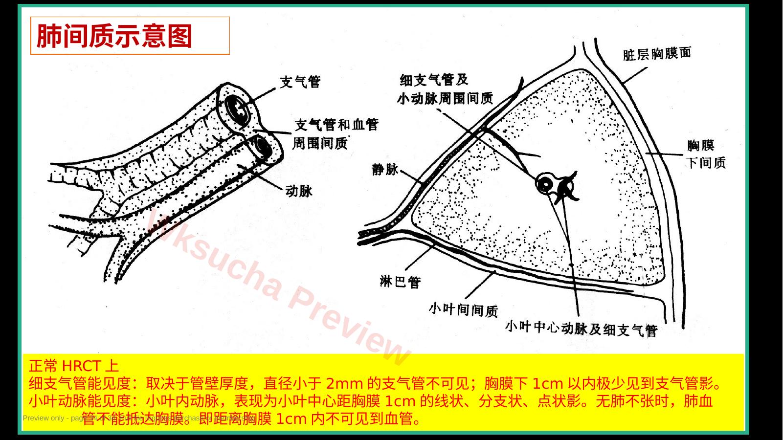 预览第 34 页