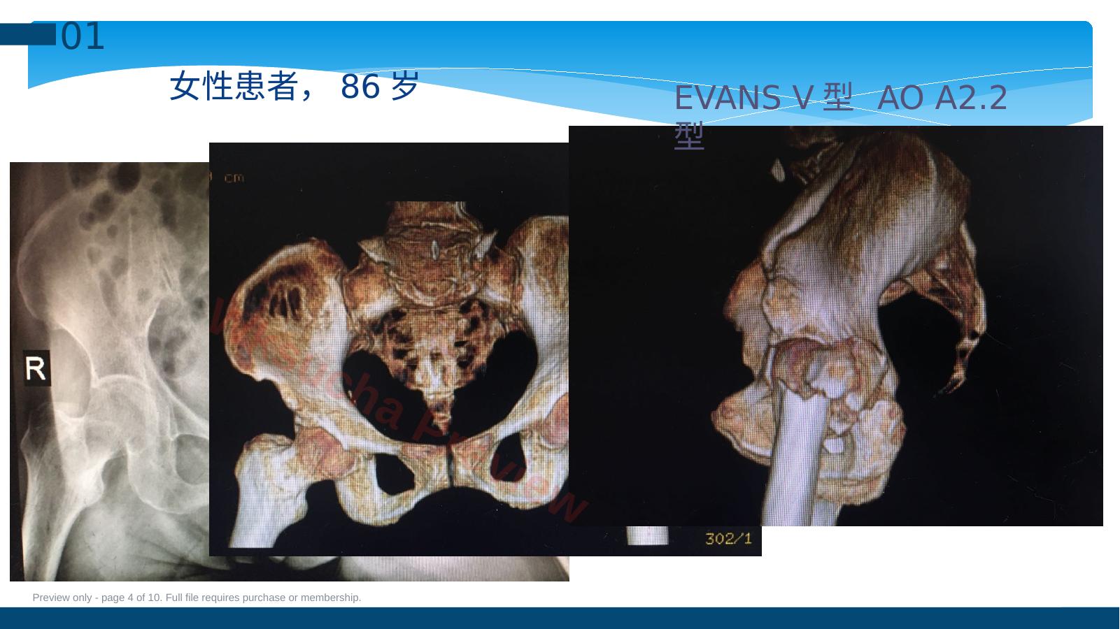预览第 4 页