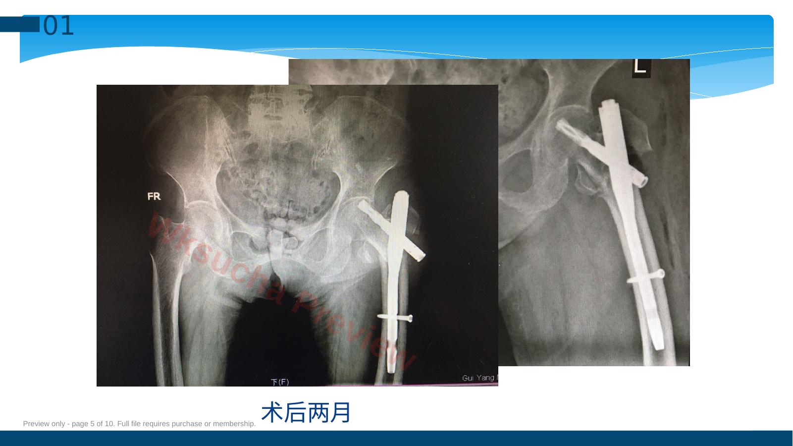 预览第 5 页
