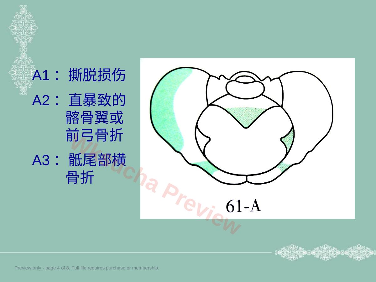 预览第 4 页