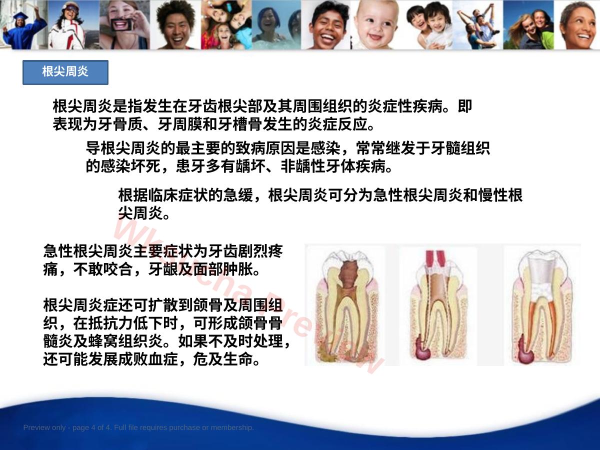 预览第 4 页