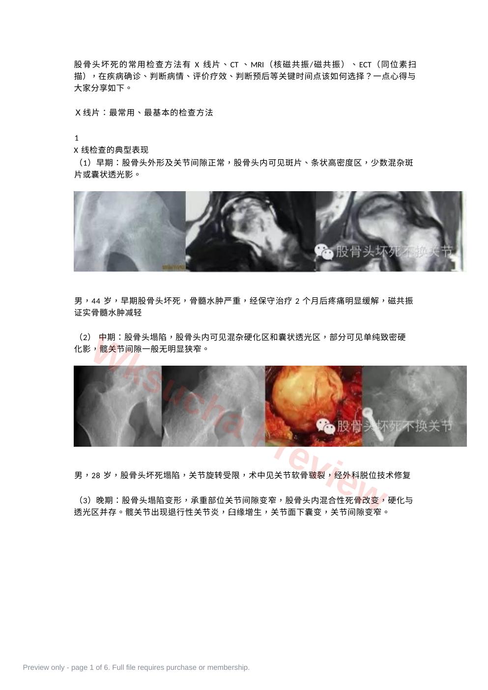 股骨头坏死应该怎样做检查