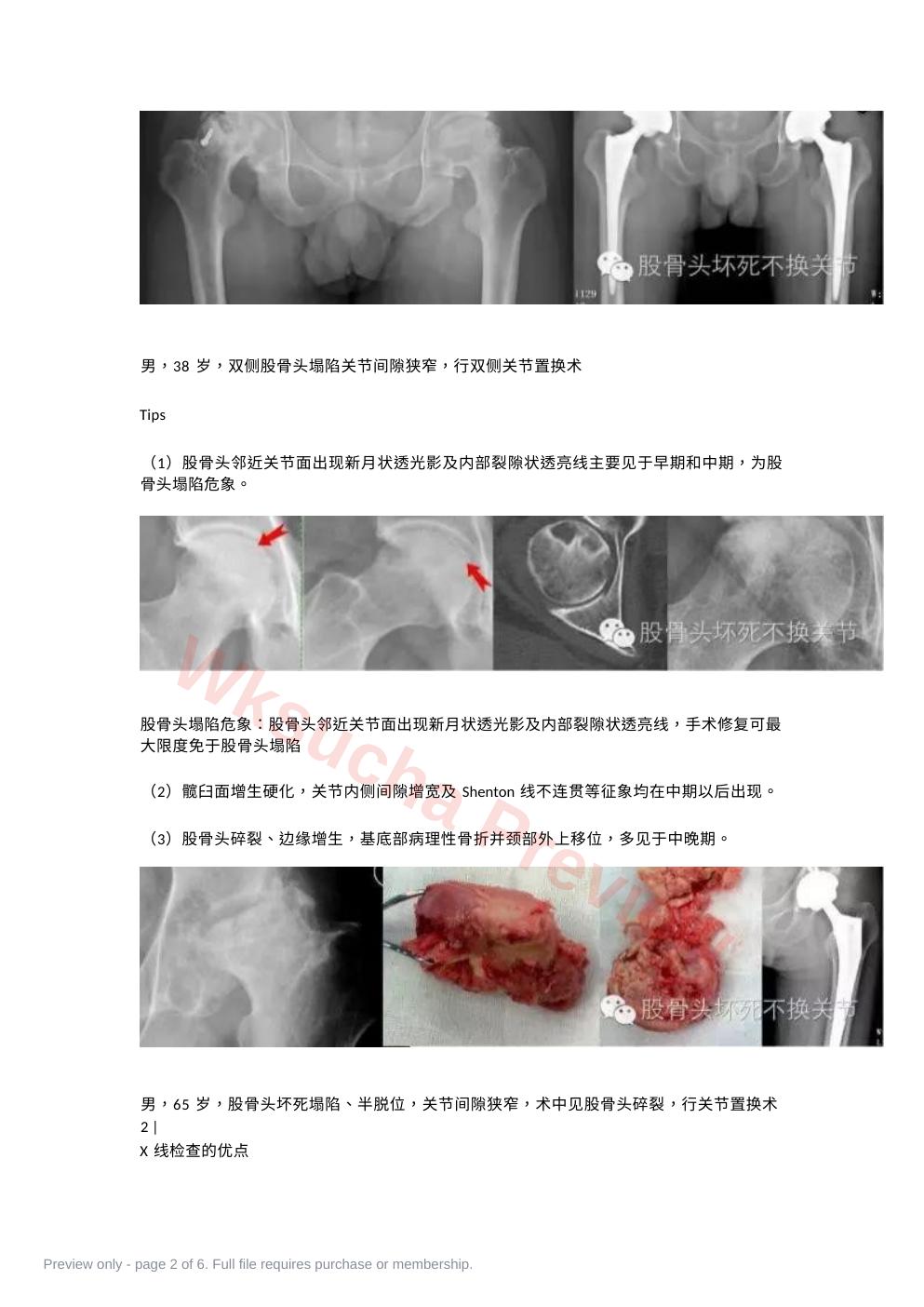 预览第 2 页