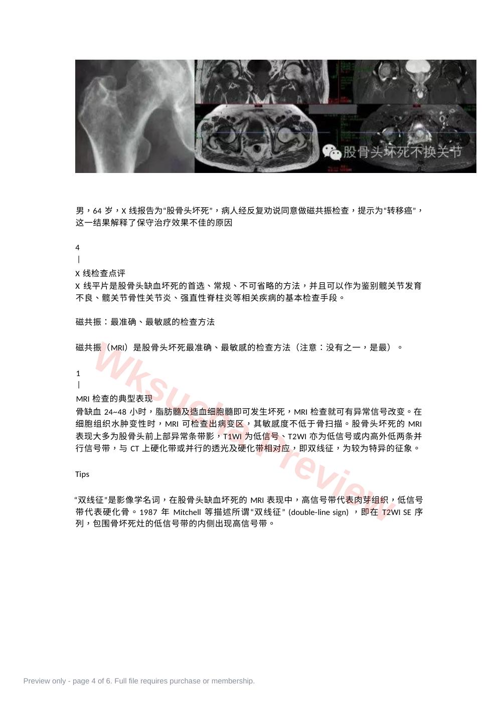 预览第 4 页