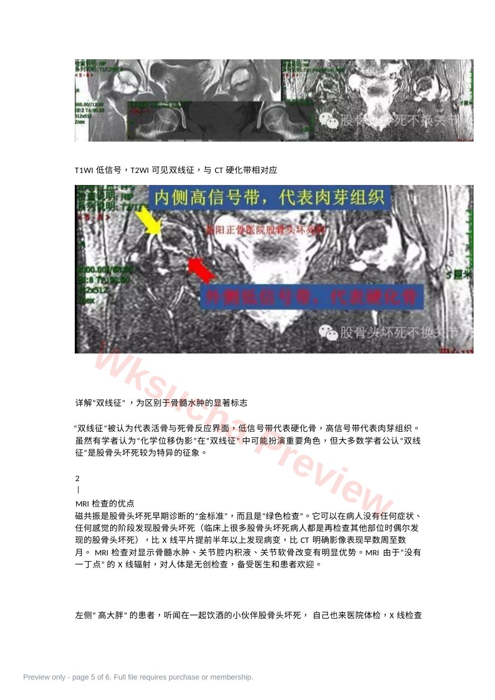 预览第 5 页