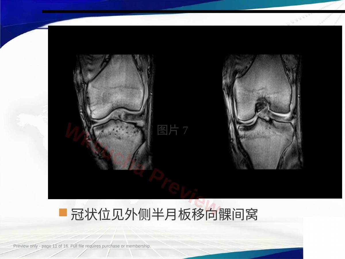 预览第 11 页