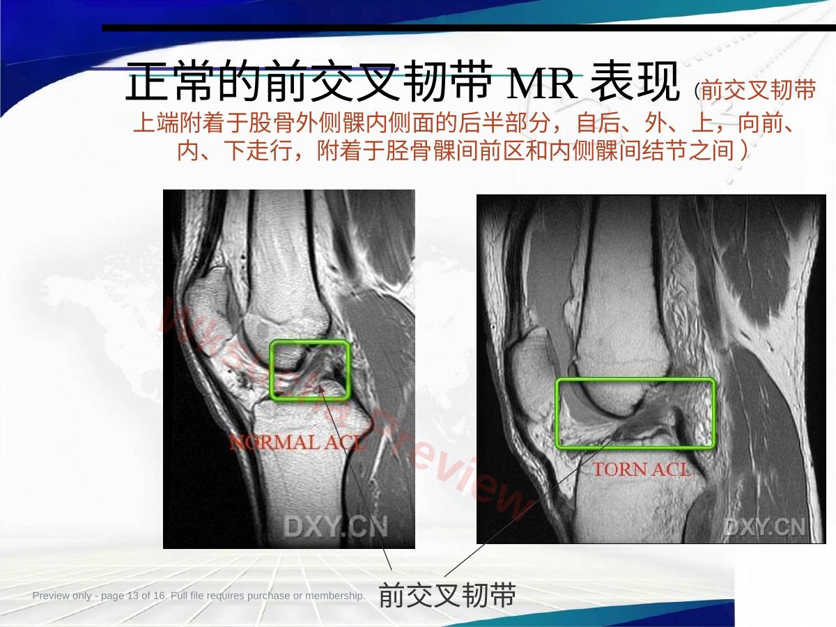 预览第 13 页