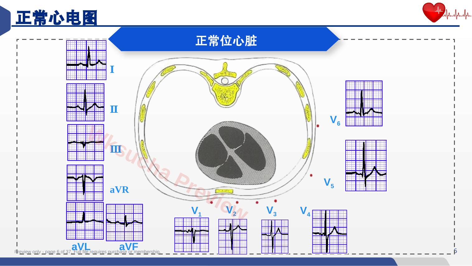 预览第 6 页