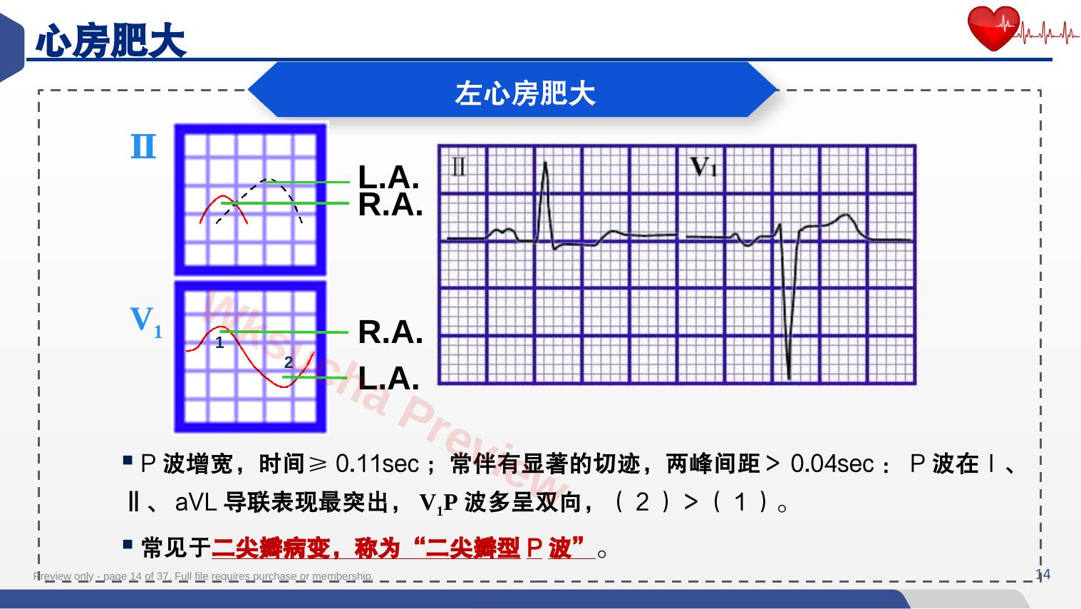 预览第 14 页