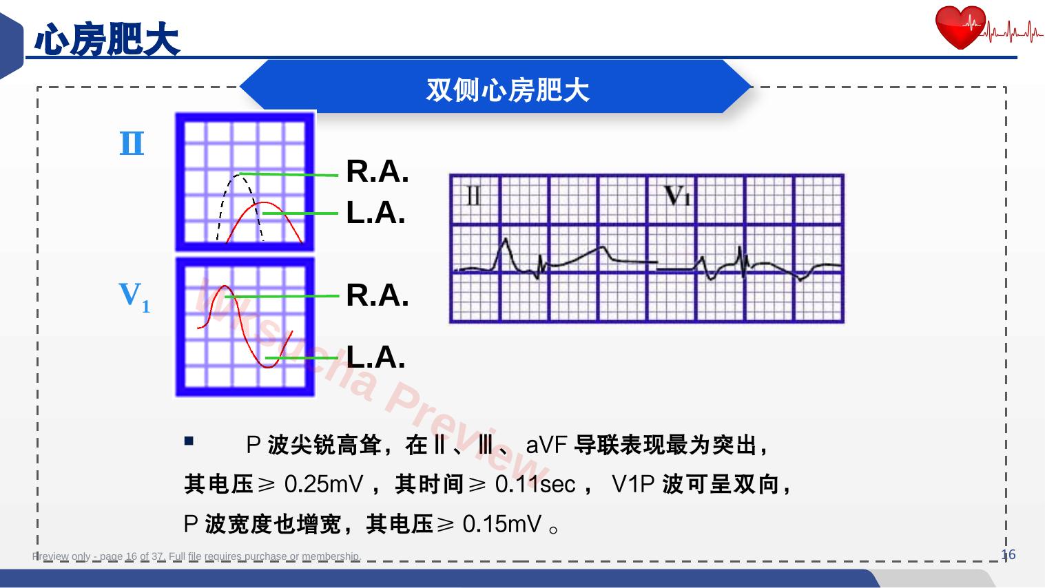 预览第 16 页