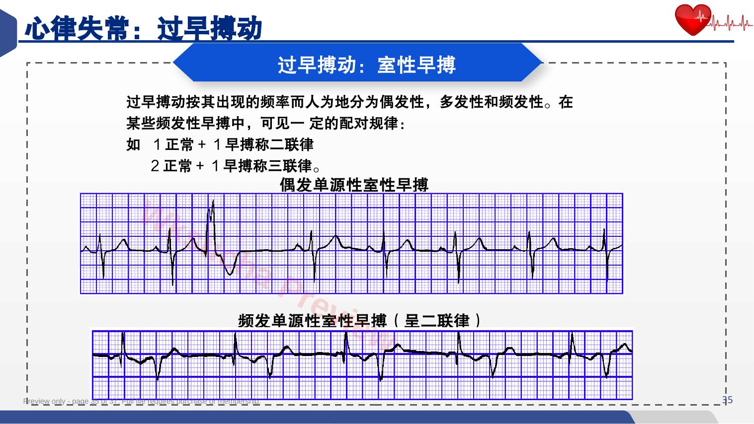 预览第 35 页