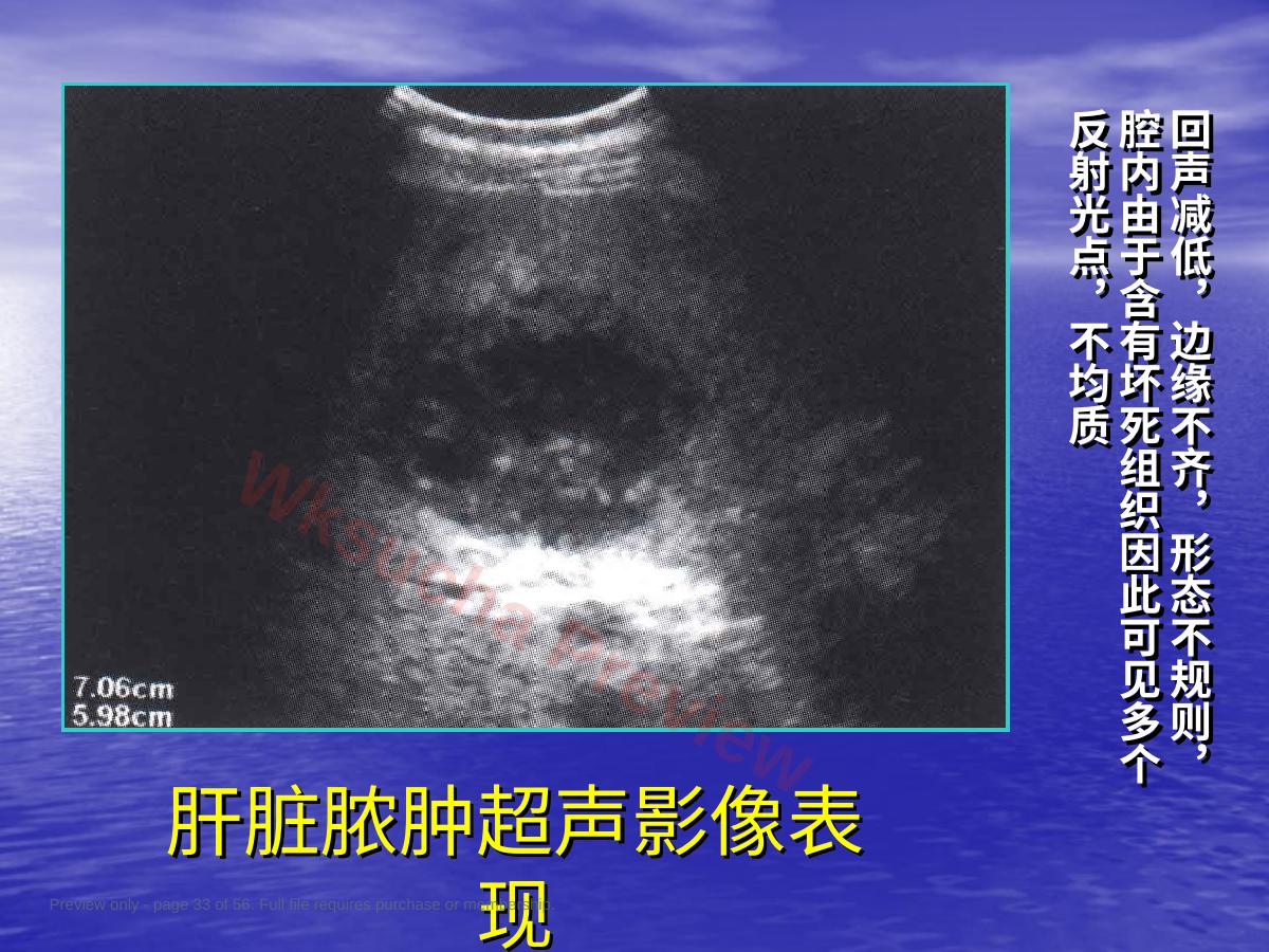 预览第 33 页