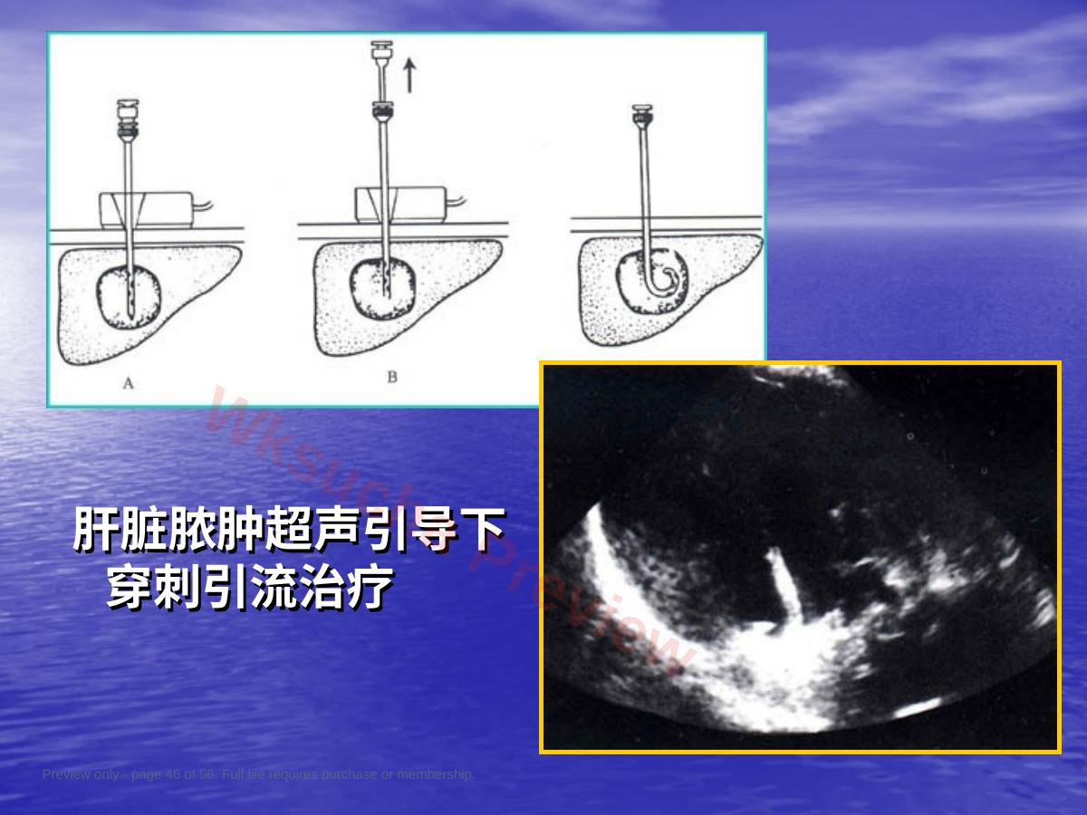预览第 46 页