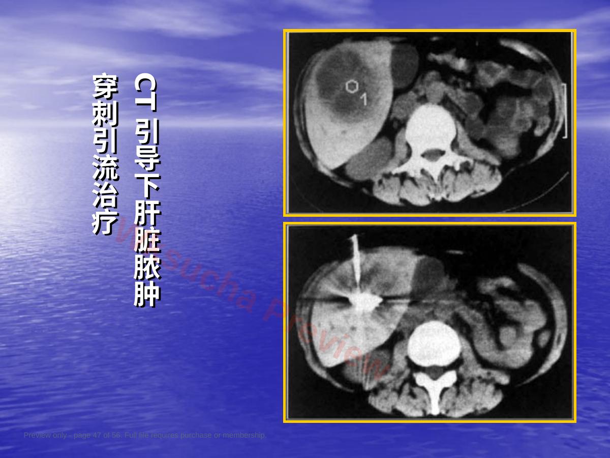 预览第 47 页