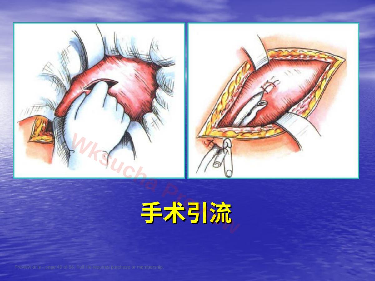 预览第 49 页