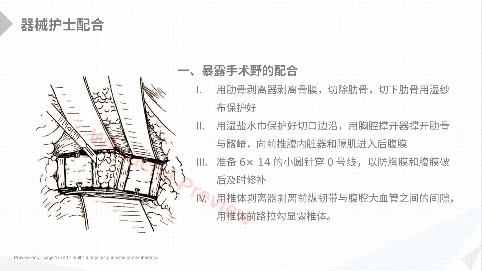 预览第 11 页