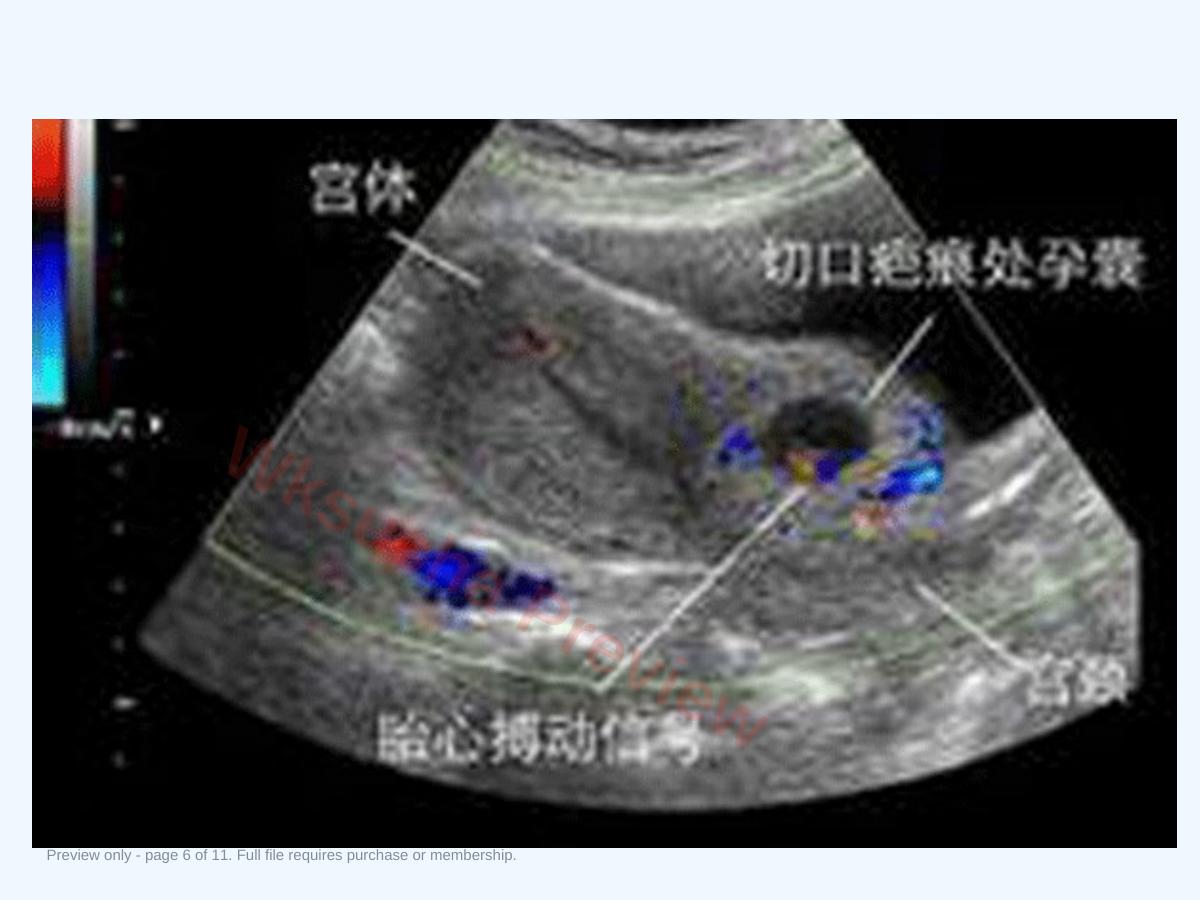 预览第 6 页