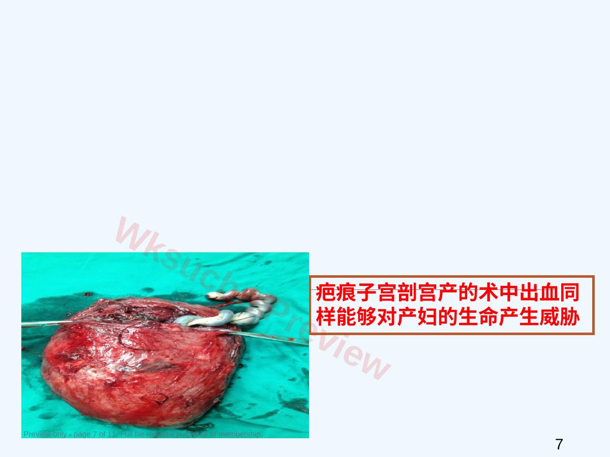 预览第 7 页