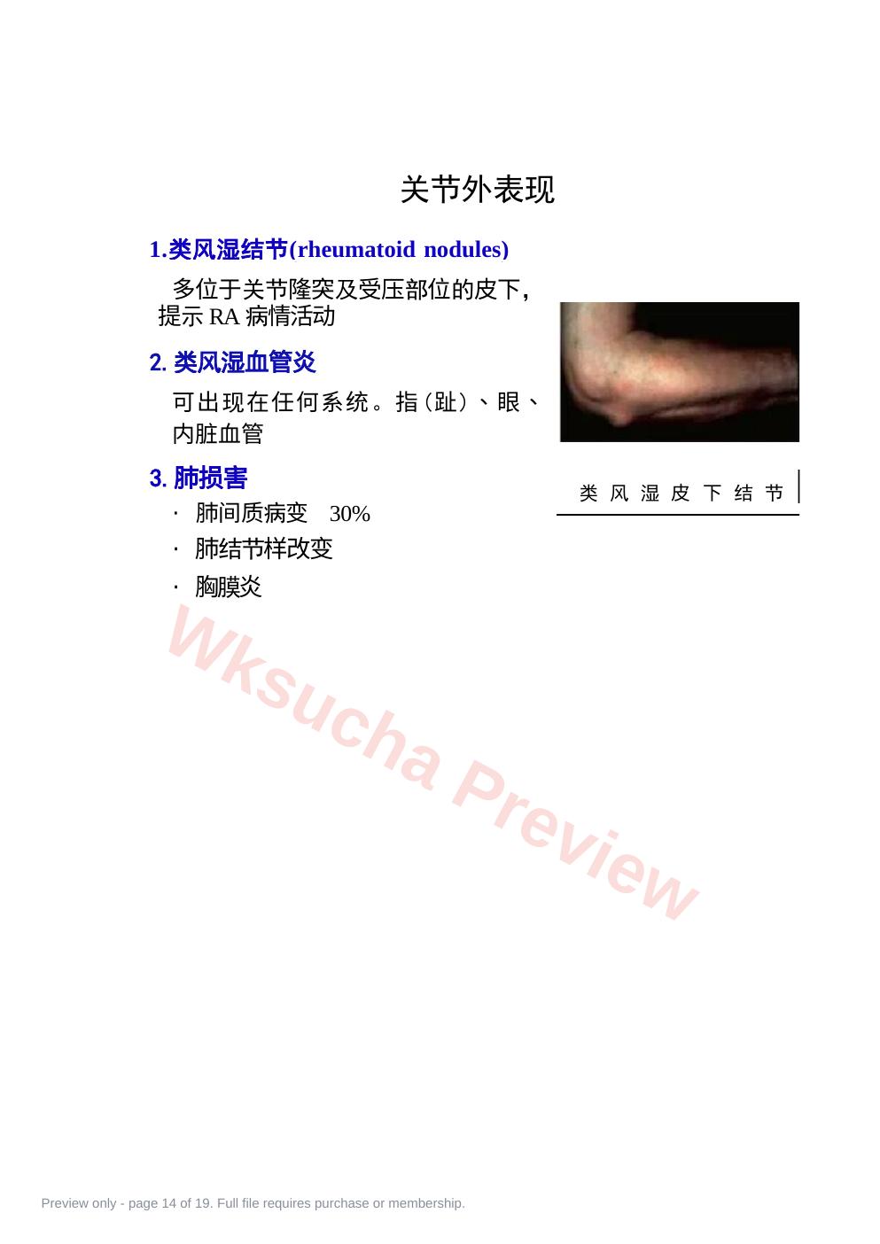 预览第 14 页