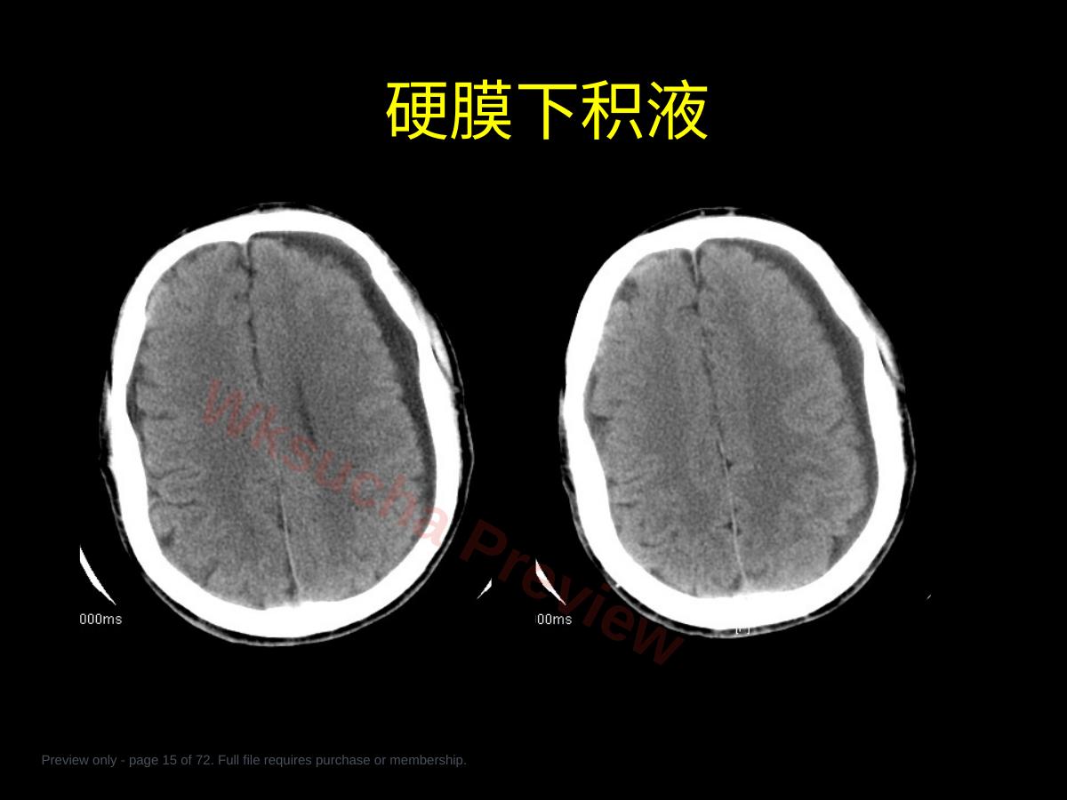 预览第 15 页