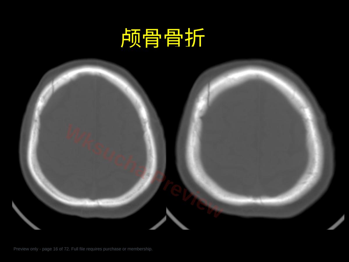 预览第 16 页