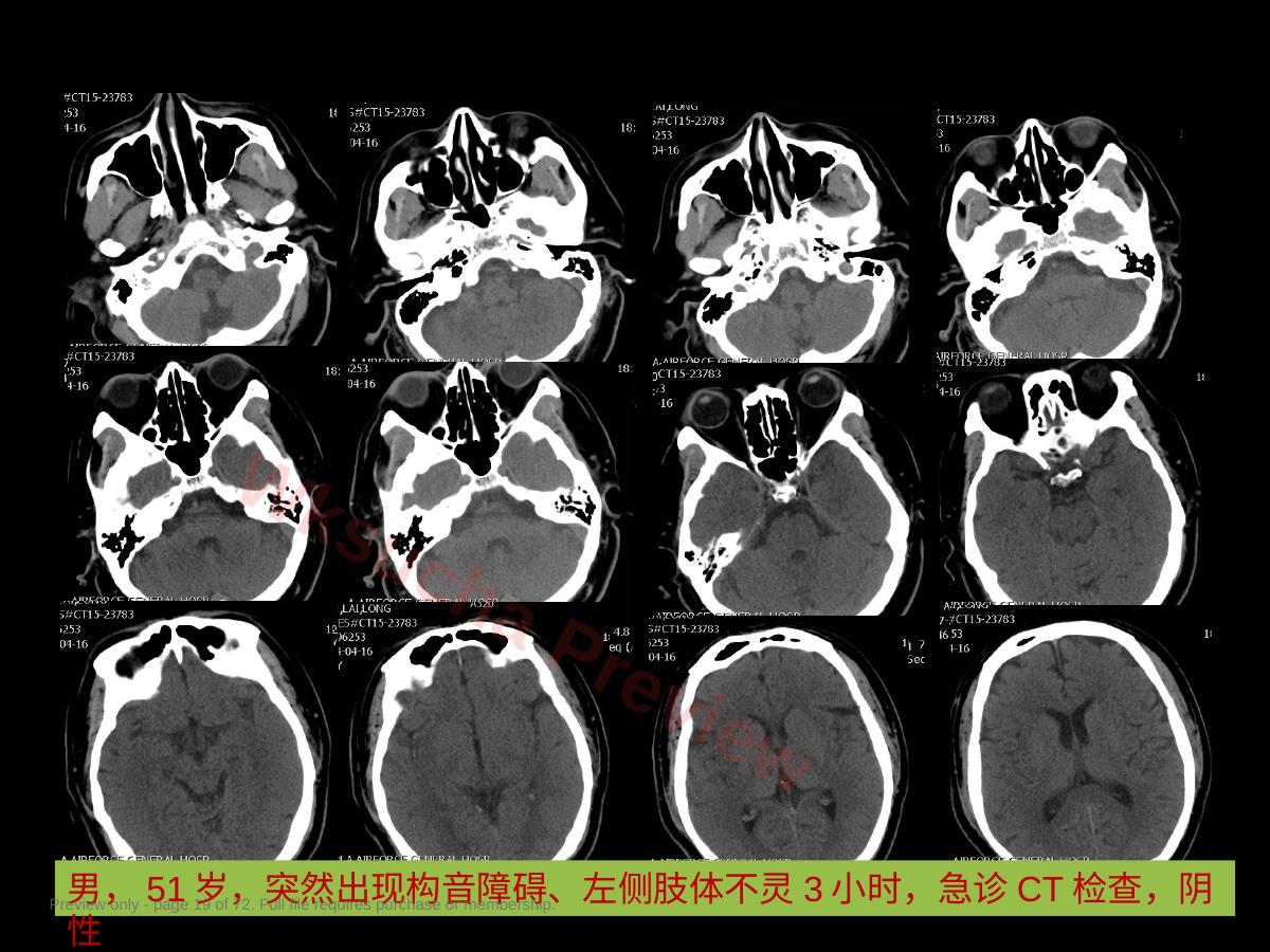 预览第 19 页