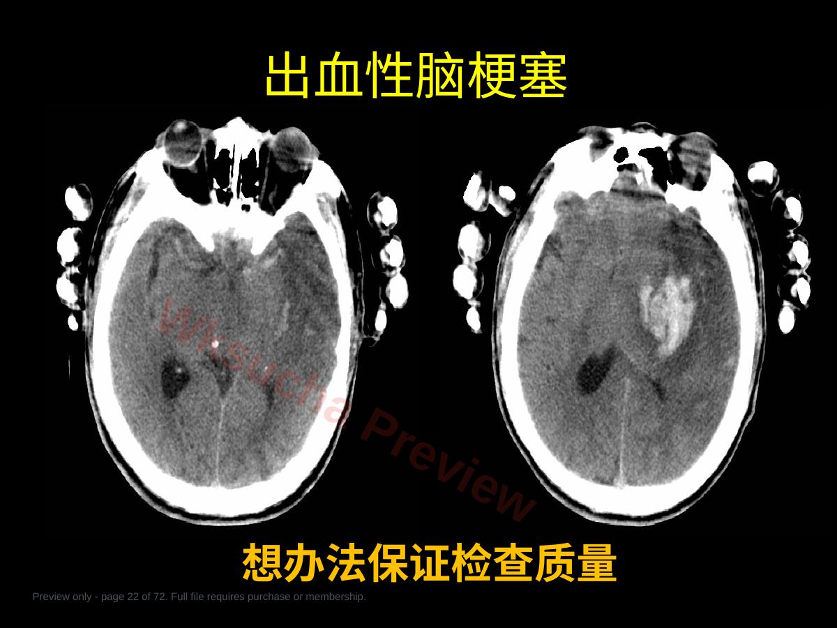 预览第 22 页