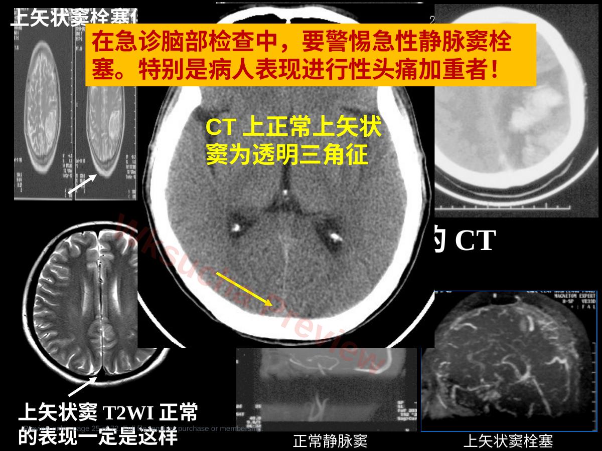 预览第 25 页