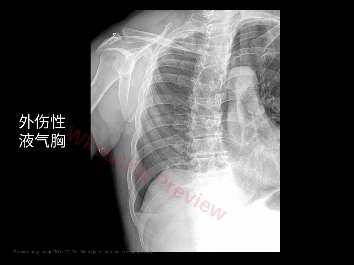 预览第 30 页