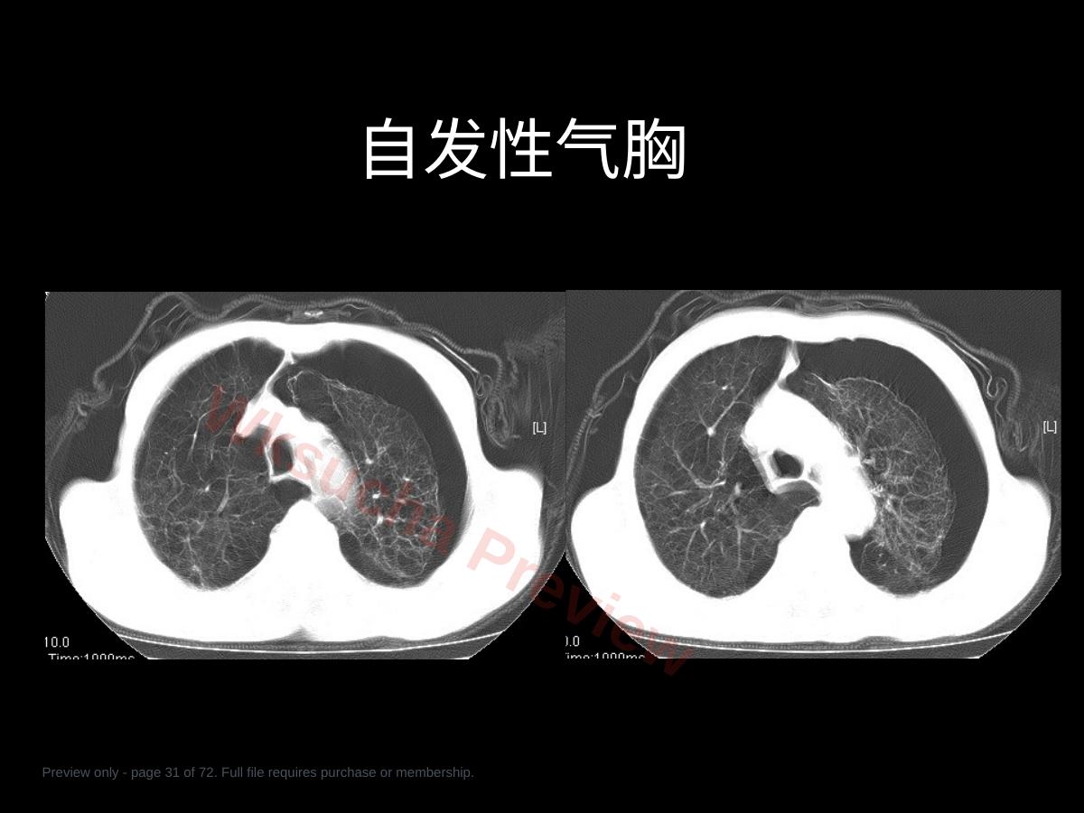 预览第 31 页