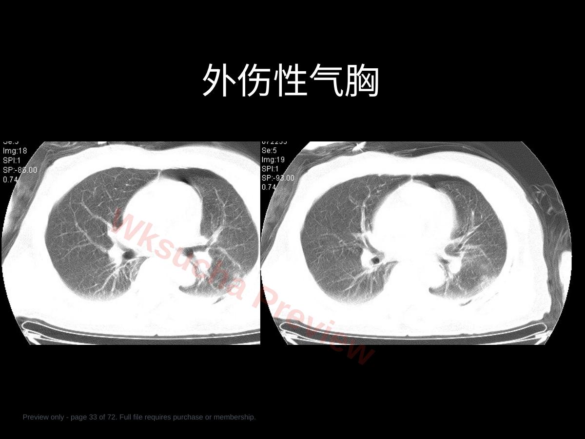 预览第 33 页