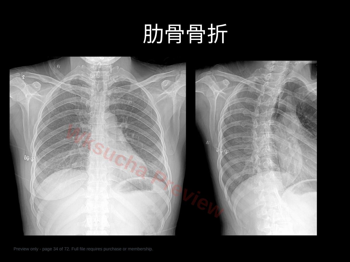 预览第 34 页