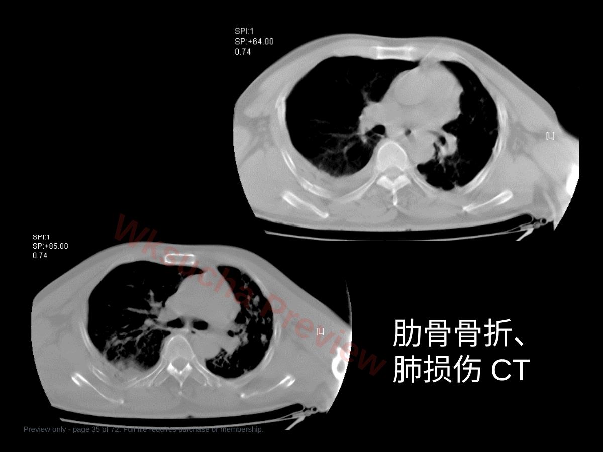 预览第 35 页