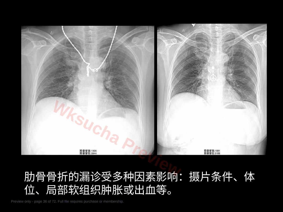预览第 36 页