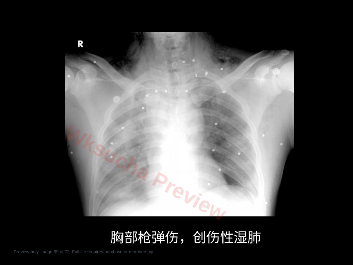 预览第 39 页