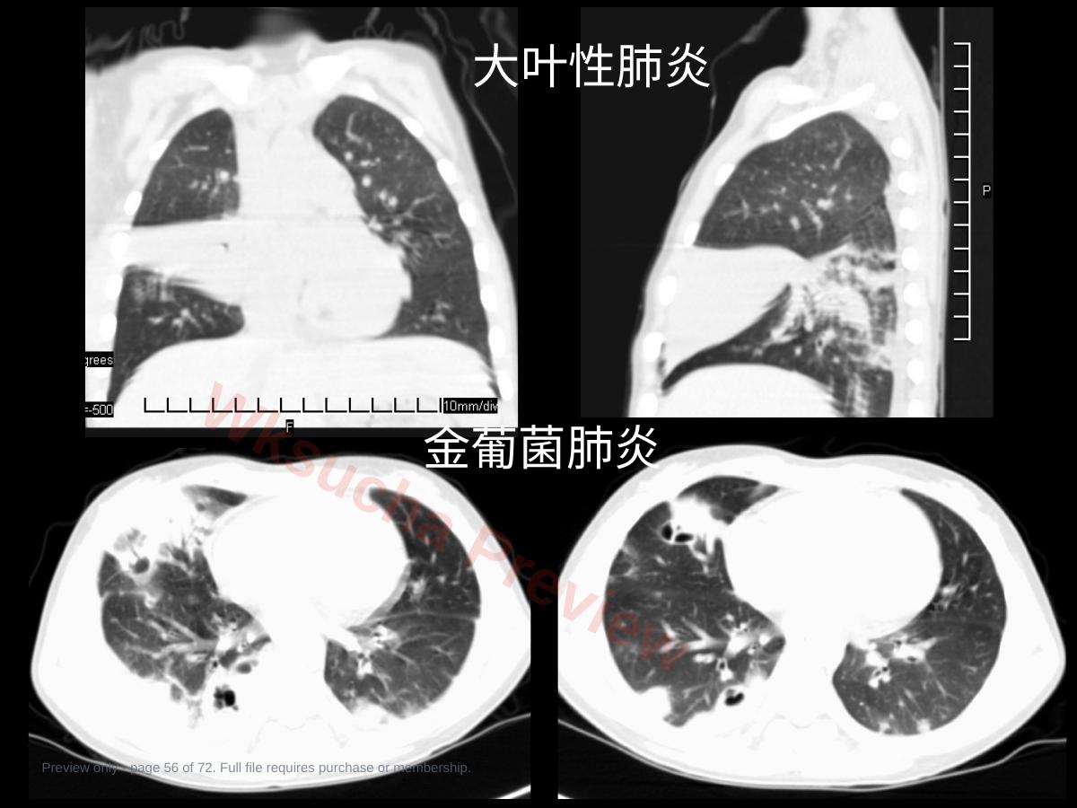 预览第 56 页