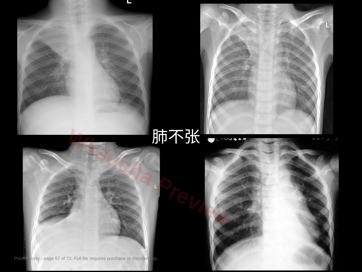 预览第 57 页