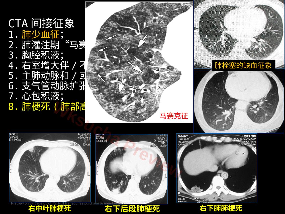 预览第 65 页