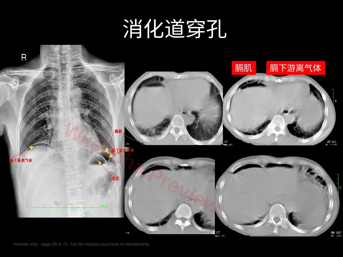 预览第 69 页