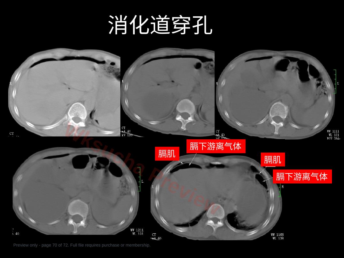 预览第 70 页